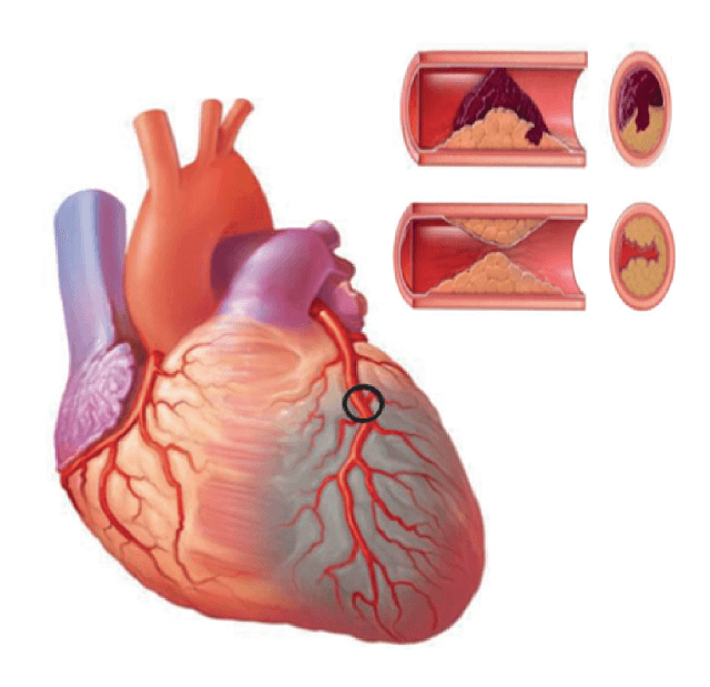 hình dạng cấu tạo tế bào cơ vân và tế bào cơ tim giống nhau và khác nhau ở những điểm nào